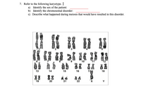 7. Refer to the following karyotype. I
a) Identify the sex of the patient:
b) Identify the chromosomal disorder:
c) Describe what happened during meiosis that would have resulted in this disorder.
2
10
11
12
88
器A 88
13
14
15
16
17
18
88
19
20
21
22
Y
