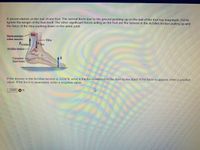 ### Educational Content on Foot Biomechanics

#### Problem Statement

A person stands on the ball of one foot. The normal force due to the ground pushing up on the ball of the foot has a magnitude of 750 N. Ignore the weight of the foot itself. The other significant forces acting on the foot are the tension in the Achilles tendon pulling up and the force of the tibia pushing down on the ankle joint.

#### Diagram Explanation

The accompanying diagram illustrates the forces acting on the foot:

- **Achilles Tendon**: The diagram shows the Achilles tendon exerting an upward force shown by an arrow labeled \( F_{\text{Achilles}} \).
- **Tibia**: An arrow labeled \( F_{\text{tibia}} \) is depicted exerting a downward force on the ankle joint.
- **Normal Force**: An arrow labeled \( N \) indicates the normal force exerted by the ground, pointing upward.
- **Anatomy of Foot**:
  - **Tibia**: Bone labeled in the upper part of the leg.
  - **Calcaneus (heel bone)**: Depicted at the bottom of the foot, where the normal force \( N \) acts.
  - **Gastrocnemius-soleus muscles**: Shown connected to the Achilles tendon.

#### Question

If the tension in the Achilles tendon is 2234 N, what is the force exerted on the foot by the tibia? If the force is upward, enter a positive value. If the force is downward, enter a negative value.

**Calculation:**
Given:
- Tension in the Achilles tendon \( T_{\text{Achilles}} \) = 2234 N (upward)
- Normal force \( N \) = 750 N (upward)

To find the force exerted by the tibia \( F_{\text{tibia}} \), we use the equilibrium condition. For vertical forces to balance:

\[ F_{\text{tibia}} + T_{\text{Achilles}} - N = 0 \]

\[ F_{\text{tibia}} + 2234 - 750 = 0 \]

\[ F_{\text{tibia}} = 750 - 2234 \]

\[ F_{\text{tibia}} = -1484 \]

So, the force exerted on the foot by the tibia is **-1484 N (downward)**.

However,