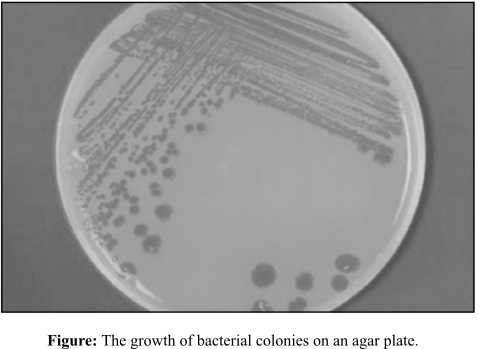 Nester's Microbiology: A Human Perspective, Chapter 28, Problem 1CT 