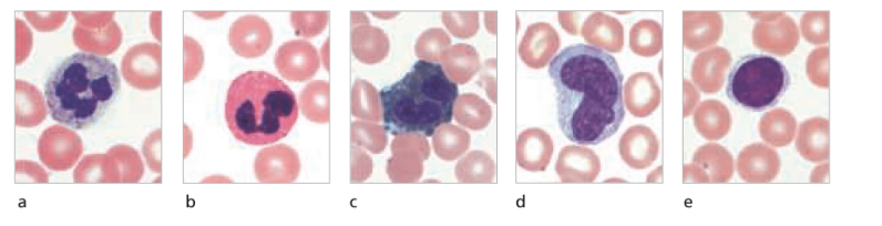 Chapter 20, Problem 5RFT, 5. The major classes of white blood cells include
(a) erythrocytes and platelets.
(b) granular and 