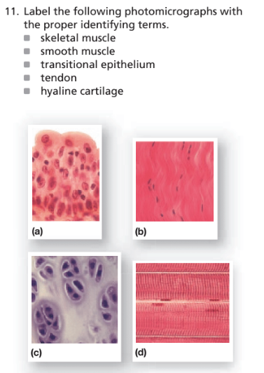 Chapter 3, Problem 11RFT, 11. Label the following photomicrographs with the proper identifying terms.
■ skeletal muscle
■ , example  1