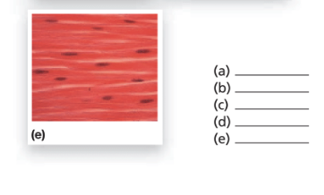 Chapter 3, Problem 11RFT, 11. Label the following photomicrographs with the proper identifying terms.
■ skeletal muscle
■ , example  2