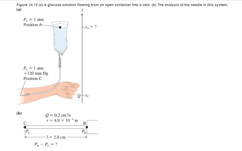 Chapter 14, Problem 63RPP, EST Intravenous (IV) feeding A patient in the hospital needs fluid from a glucose nutrient bag. The , example  1