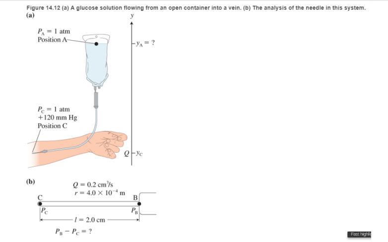Chapter 14, Problem 64RPP, EST Intravenous (IV) feeding A patient in the hospital needs fluid from a glucose nutrient bag. The 