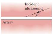 Chapter 17, Problem 83P, SSMUltrasound, which consists of sound waves with frequencies above the human audible range, can be 