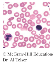 Chapter 9.1, Problem 75PE, 75.	The normal number of white blood cells for human blood is between 4800 and 10,800 cells per 