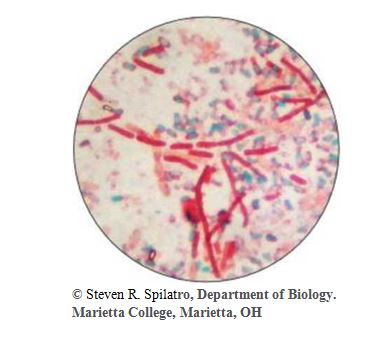 Chapter 19.L2, Problem 2VC, 2. From chapter 3, figure 3.8. What type of bacterial infection could be diagnosed using the stain 