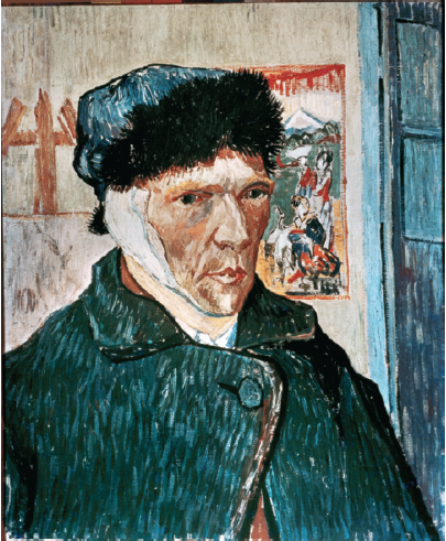 Chapter 7, Problem 2SA, Dutch painter Vincent van Gogh was emotionally troubled and once cut off part of his own ear. His 