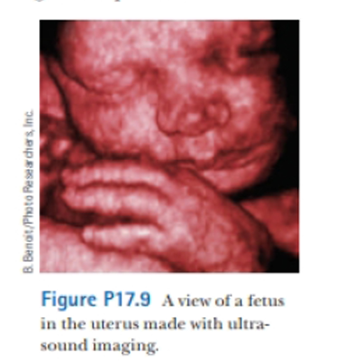 Chapter 17, Problem 17.9P, Ultrasound is used in medicine both for diagnostic imaging (Fig. P17.9, page 526) and for therapy. 