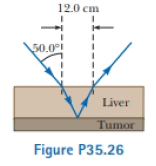 Chapter 35, Problem 35.26P, A narrow beam of ultrasonic waves reflects off the liver tumor illustrated in Figure P35.26. The 