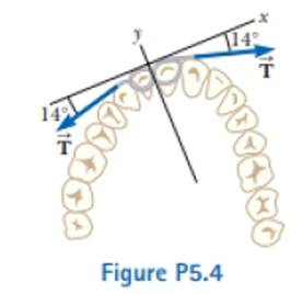 Chapter 5, Problem 5.4P, A certain orthodontist uses a wire brace to align a patients crooked tooth as in Figure P5.4. The 