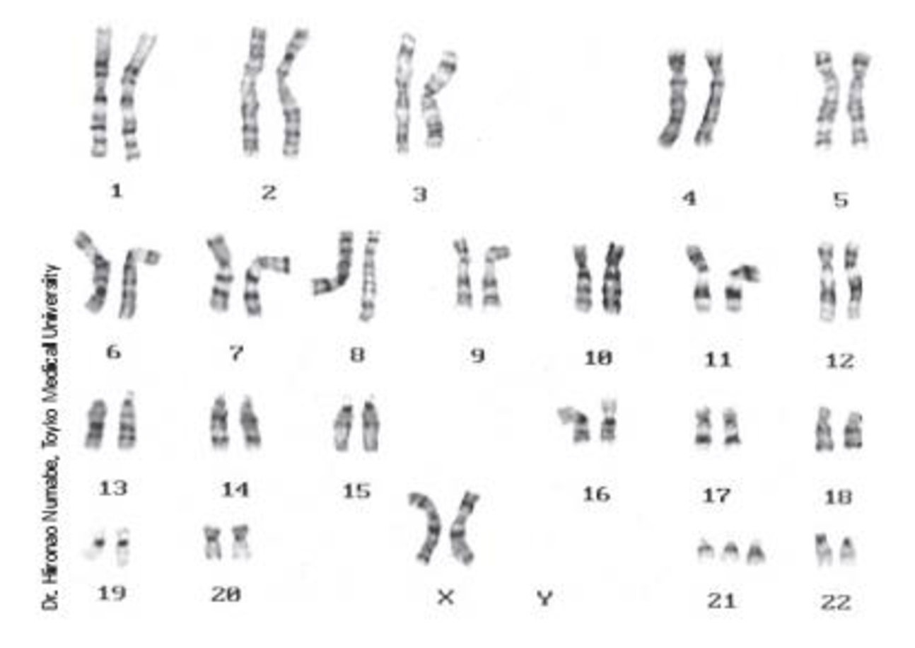 Chapter 6, Problem 2QP, Given the karyotype shown at right, is this a male or a female? Normal or abnormal? What would the 
