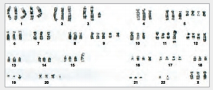 Chapter 11, Problem 2DAA, HeLa Cells Are a Genetic Mess HeLa cells can vary in chromosome number. Defects in proteins that 