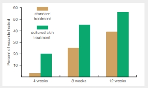 Chapter 31, Problem 3DAA, Cultured Skin for Healing Wounds Diabetes is a disorder in which the blood sugar level is not 