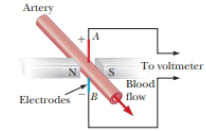 Chapter 28, Problem 47AP, A heart surgeon monitors the flow rate of blood through an artery using an electromagnetic flowmeter 