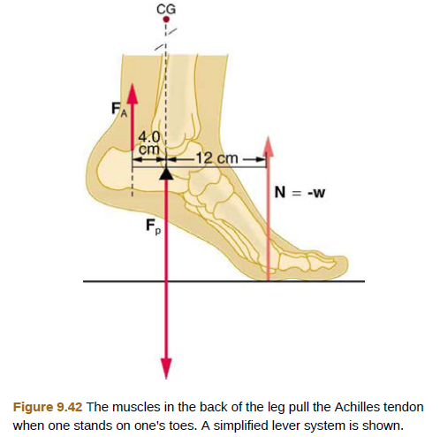 Chapter 9, Problem 33PE, A 75-kg man stands on his toes by exerting an upward force through the Achilles tendon, as in Figure 