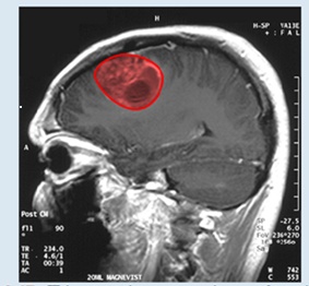 Chapter 6.4, Problem 1SP, Measuring Area from a Boundary: The Planimeter Figure 6.47 This magnetic resonance image of a , example  1