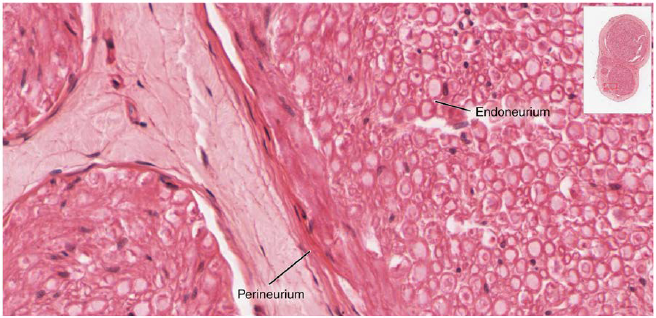 Chapter 13, Problem 11ILQ, Figure 13.22 To what structures in a skeletal muscle are the endoneurium, perineurium, and 