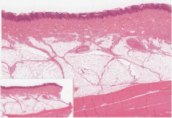 Chapter 5, Problem 2ILQ, Figure 5.4 If you zoom on the cells at the outermost layer of this section of skin, what do you 