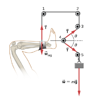 Chapter 5, Problem 55P, Common Forces A leg is suspended in a traction system, as shown below (a) Which pulley in the figure 
